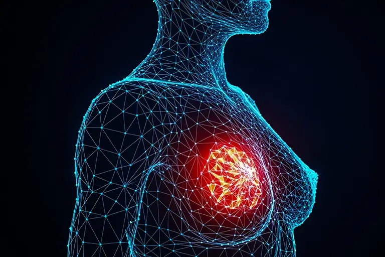 A woman's breast is depicted with a wireframe overlay, highlighting its contours in a graphic representation.